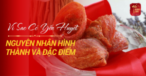 vi-sao-co-yen-huyet-0